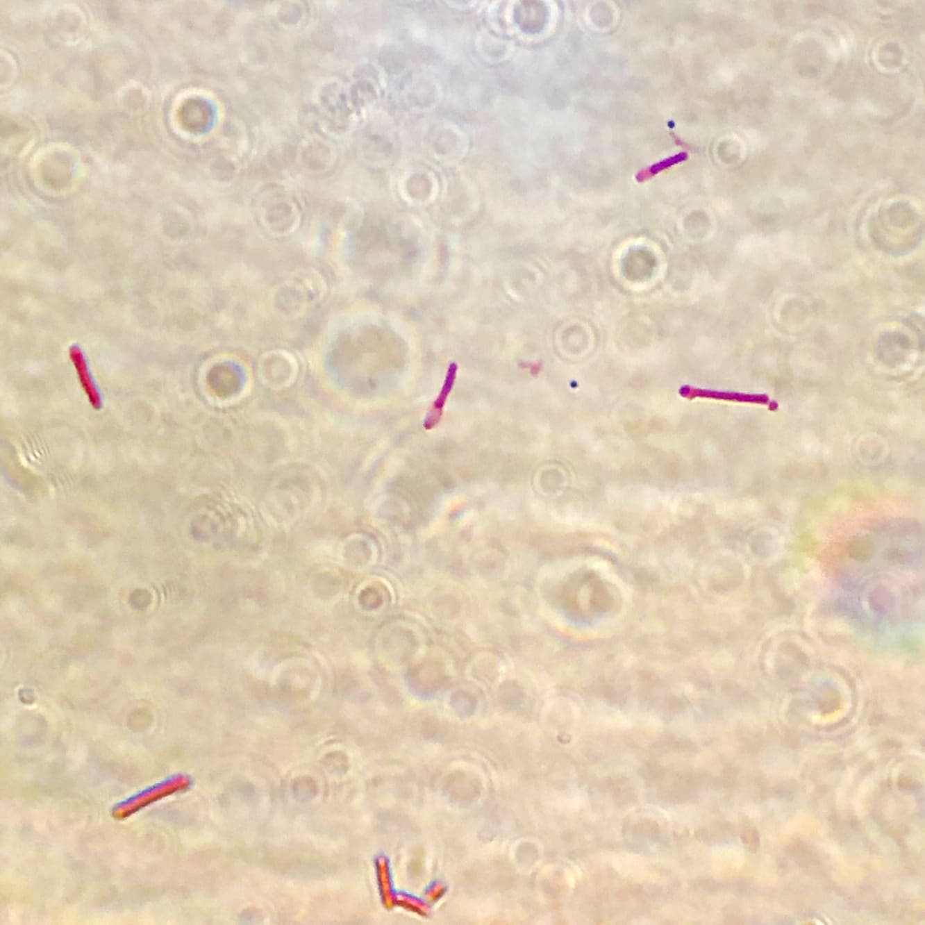 gram perfringens spore infection virale